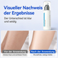 🧊✨ Eiskühlende Haarentfernung – Schmerzfreie Haarentfernung bis zur Wurzel | Premium Qualität